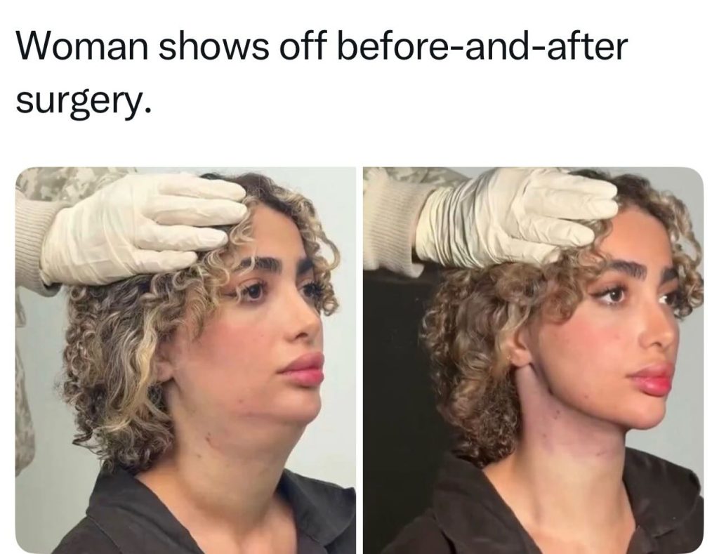 Before & After Surgery Transformation Will Shock You 😱 – The Greennest